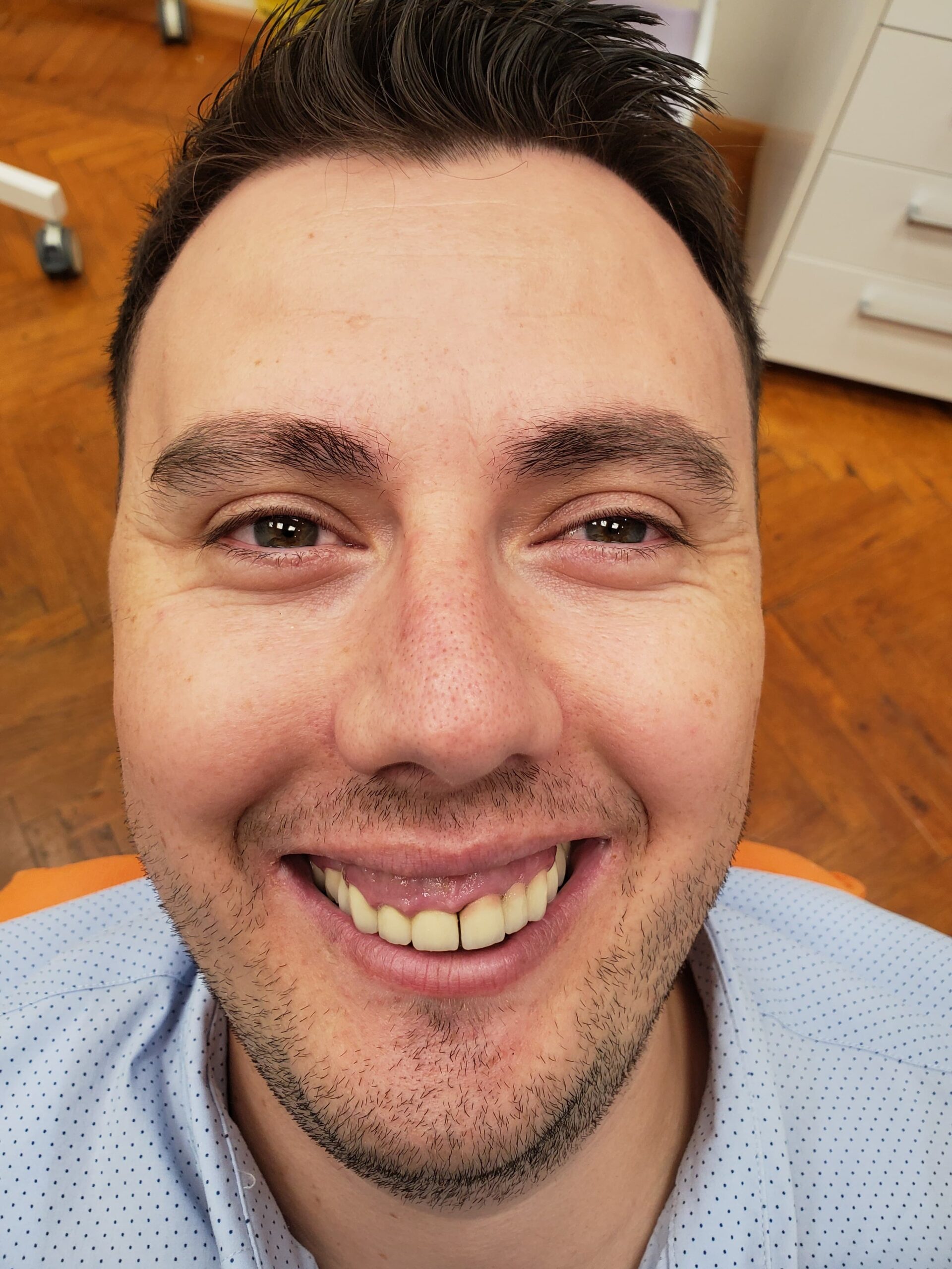 Full-mouth rehabilitation with zirconia and E.max crowns — photograph 3 of 6