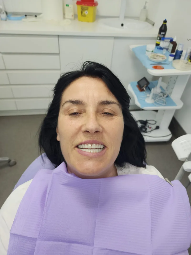 Before and after photograph — Closing gaps with full zirconia crowns