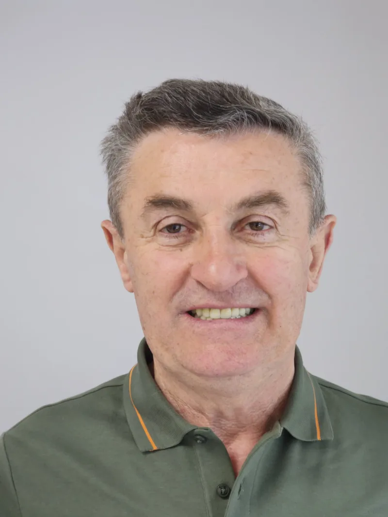 Before and after photograph — Comprehensive smile rehabilitation with implants and crowns